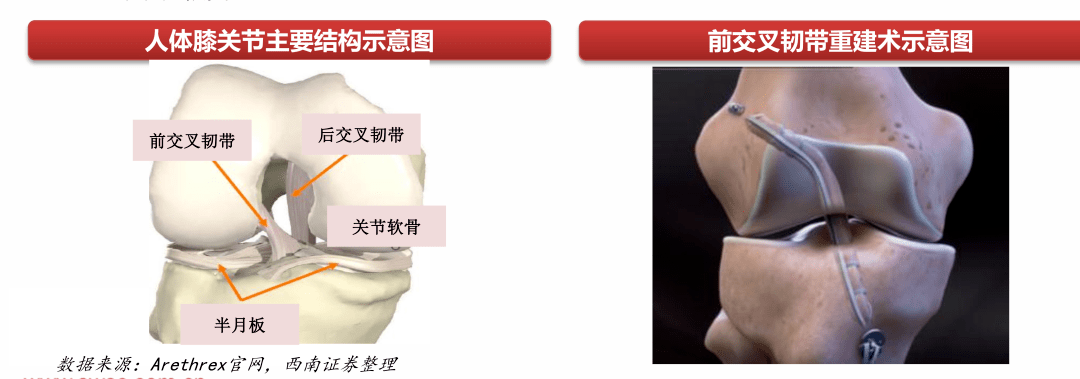 膝關(guān)節(jié)結(jié)構(gòu) 膝關(guān)節(jié)結(jié)構(gòu)